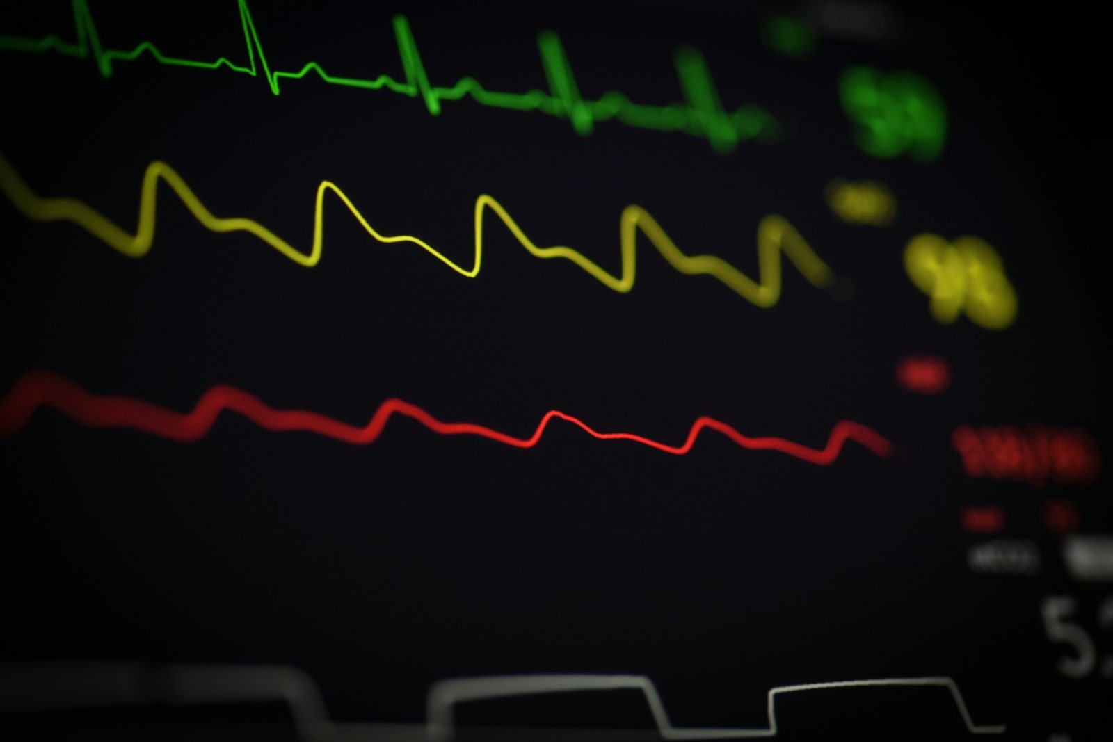 EKG-kurve på hjertemonitor