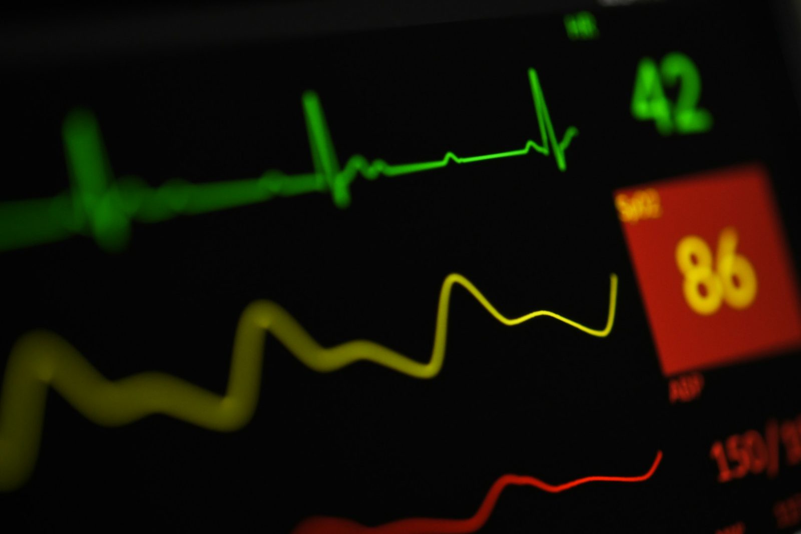 EKG-monitor med hjertefrekvenskurve på skjerm